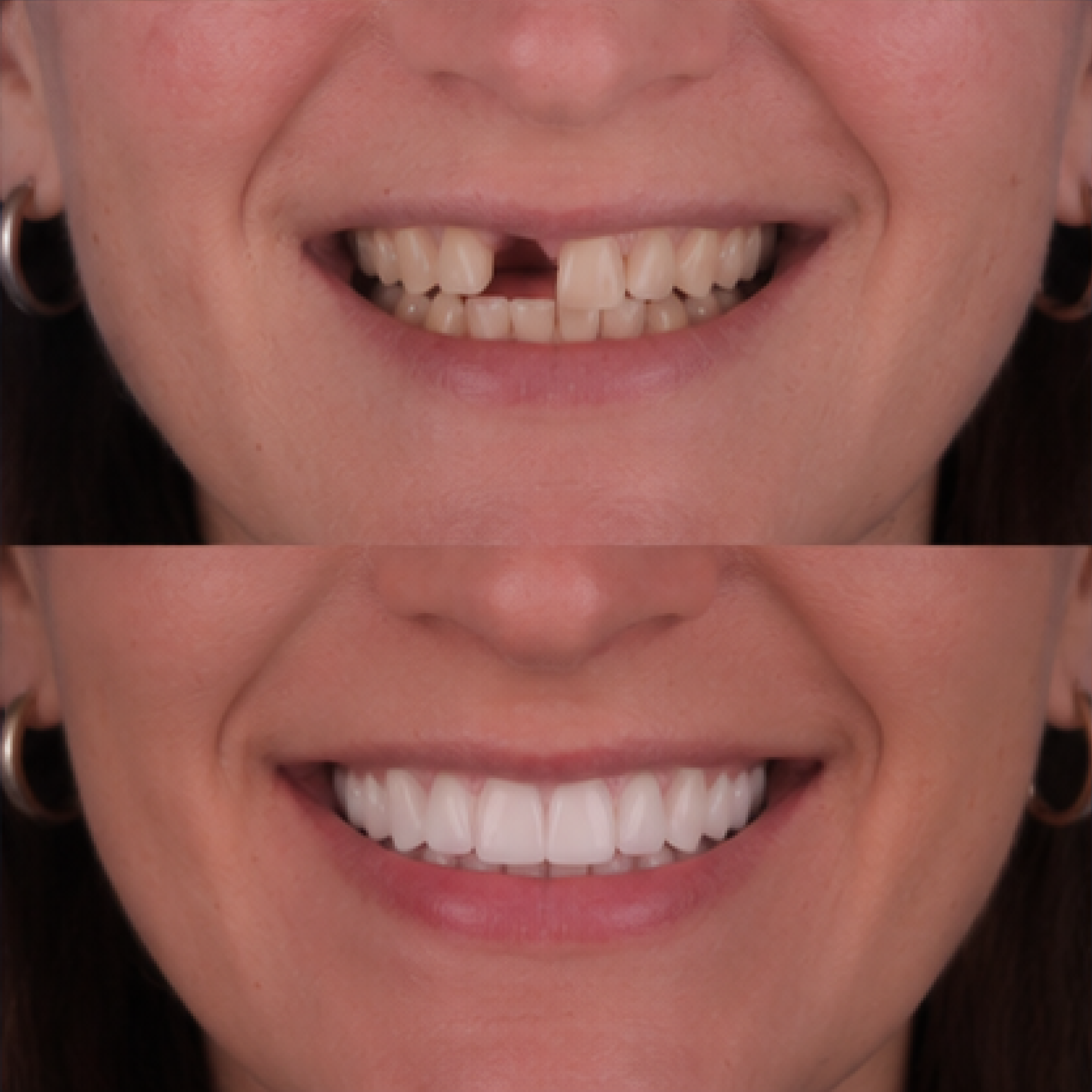 Функция и естественная форма — клиническая история Premium Smile